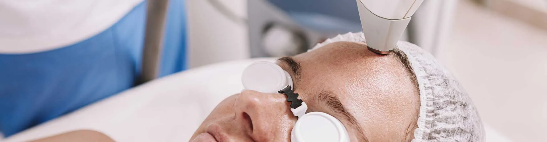 Forehead Laser Hair Removal (Female)