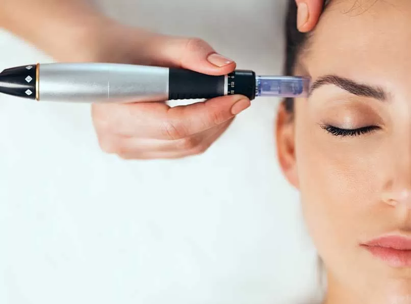 Effects of Dermapen Treatment: Is It Really Effective?