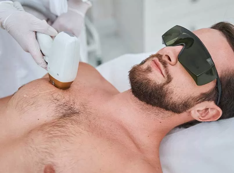 Erkek Epilasyonunda Dikkat Edilmesi Gerekenler