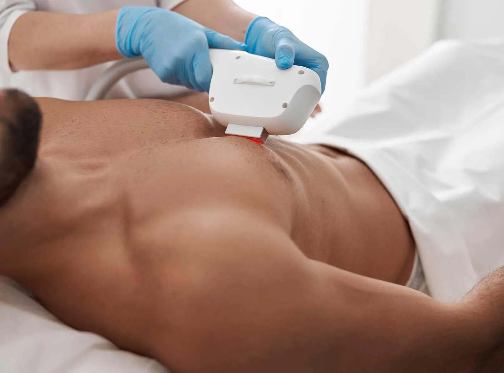 Erkek Lazer Epilasyon Bölgeleri: Detaylı Rehber ve Harita