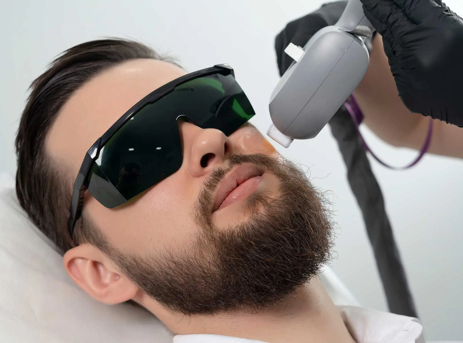 Erkek Lazer Epilasyon: İşlem, Acı ve Teknoloji Rehberi