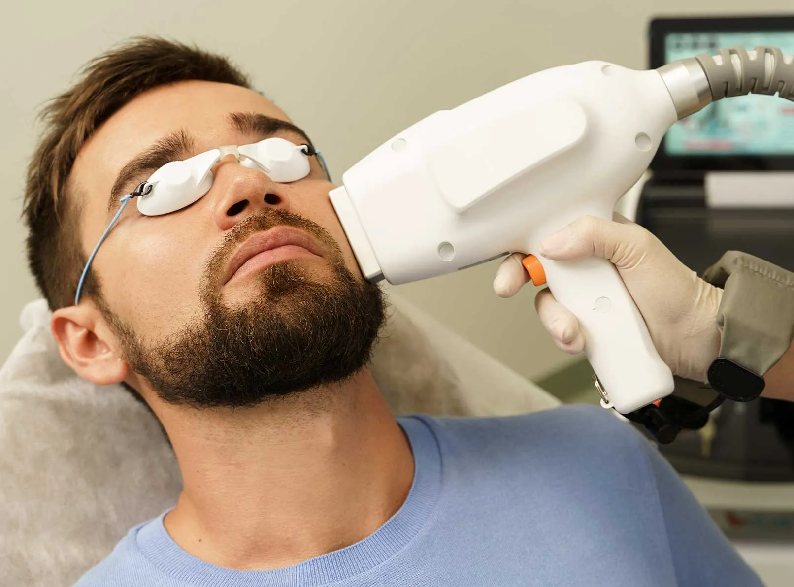 Erkek Yüz Epilasyonu: Sakal Üstü ve Kaş Arası Çözümleri