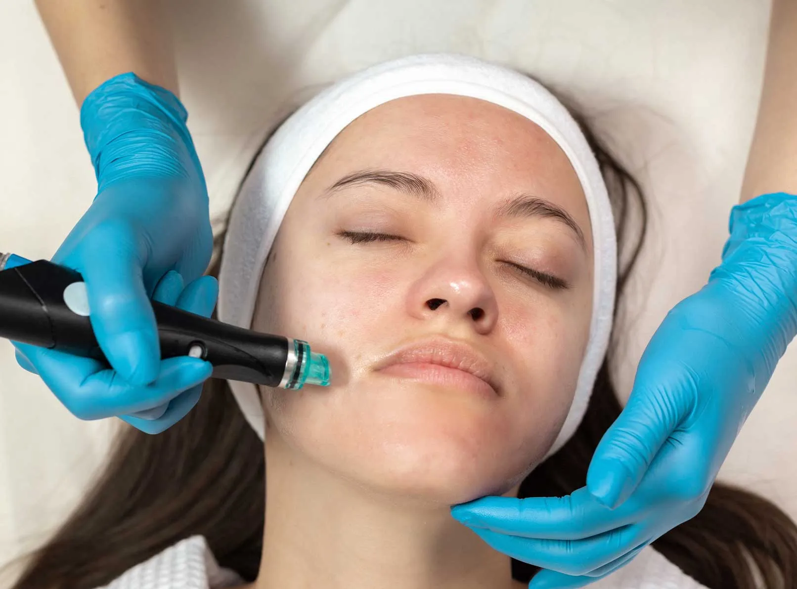 Hydrafacial Skincare: Deep Cleansing and Renewal Guide