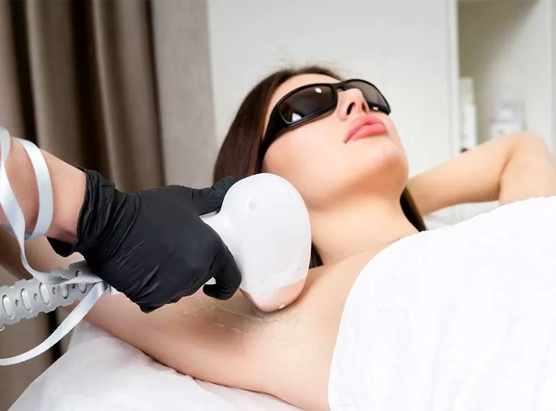 Lazer Epilasyon İçin İdeal Yaş: Doğru Zaman Ne Zaman?