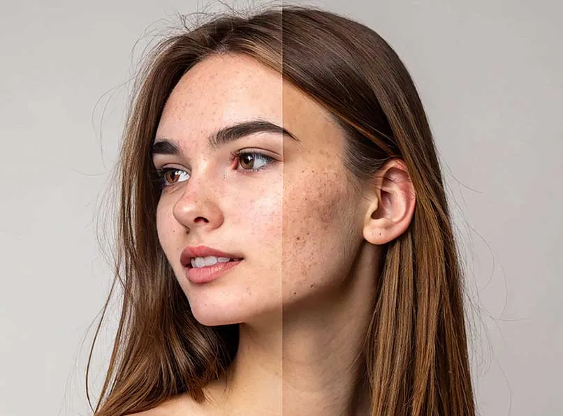 Spot Care: Solutions for Uneven Skin Tone with SnowCell