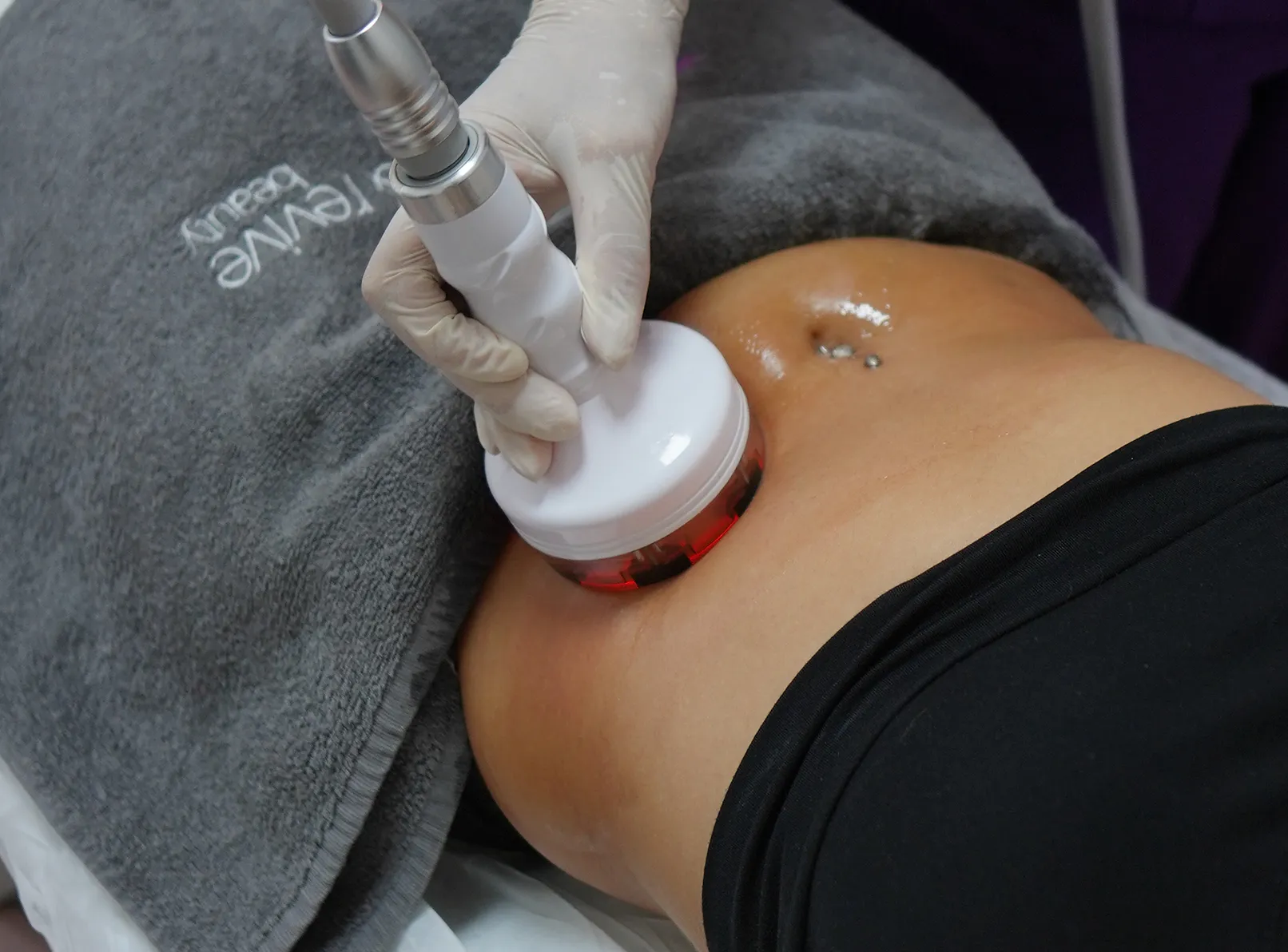 Magic Shape for Targeted Slimming: Effective on Abdomen and Legs