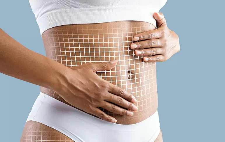 Magic Shape: The Ultimate in Body Sculpting