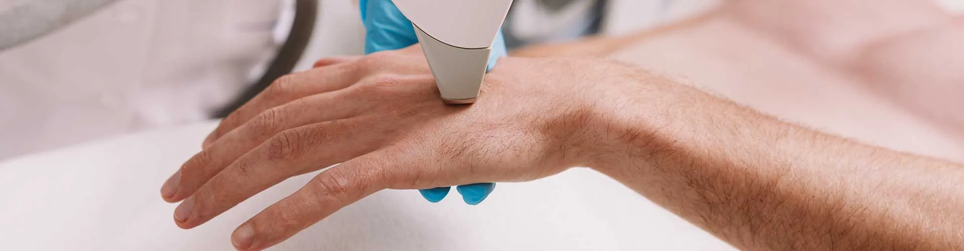 Handheld Laser Hair Removal (Male)