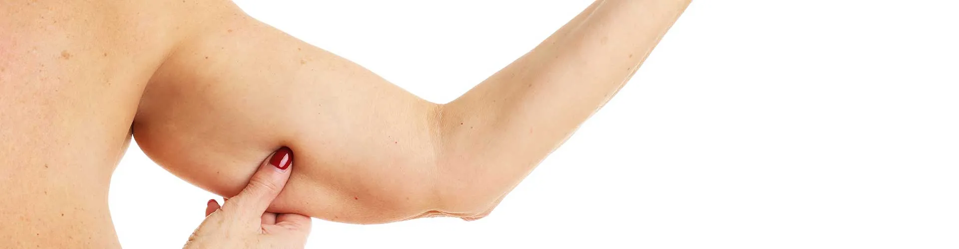 G5 Arm
