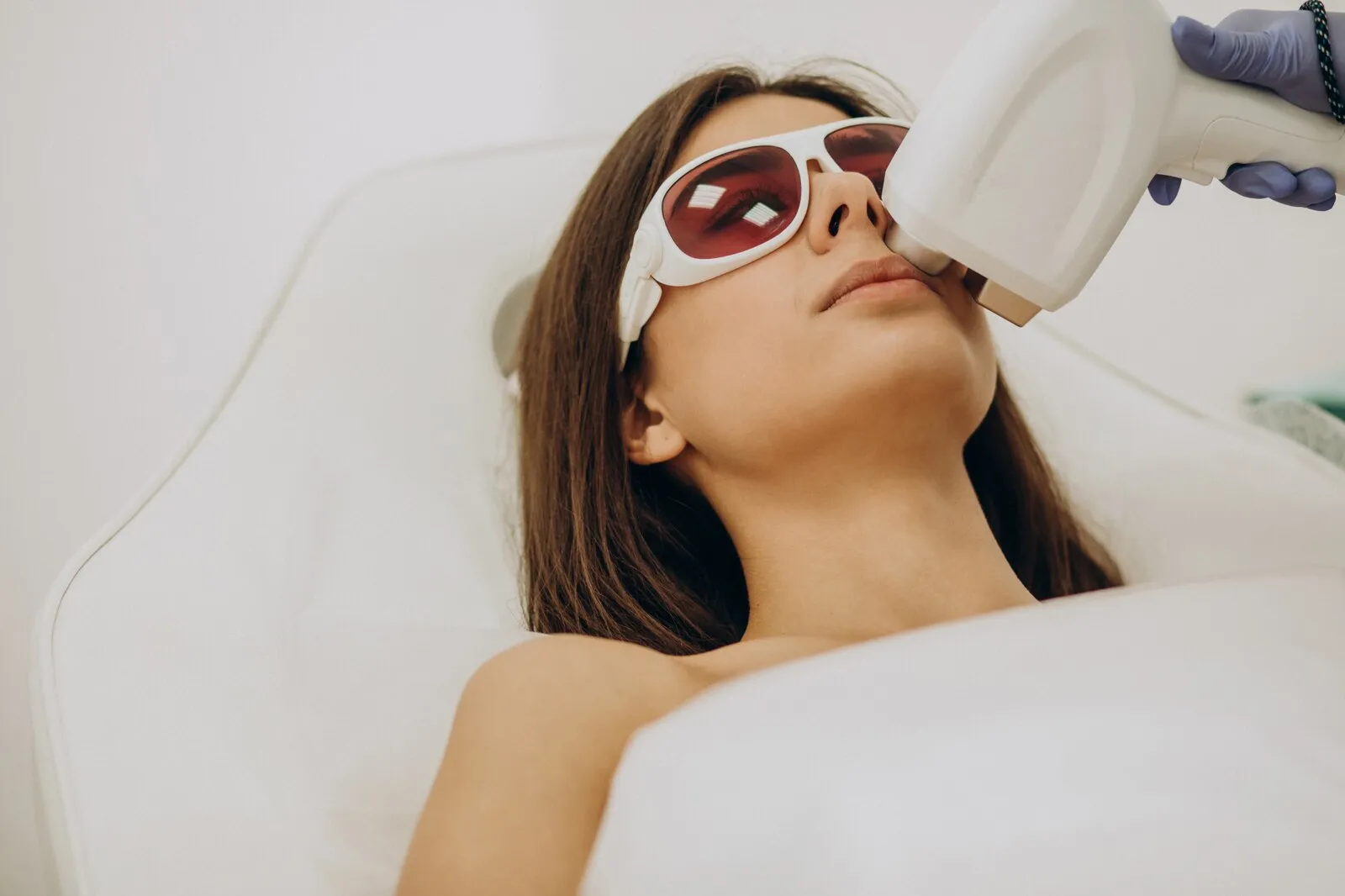 Laser Hair Removal for Hirsutism and PCOS: What to Expect