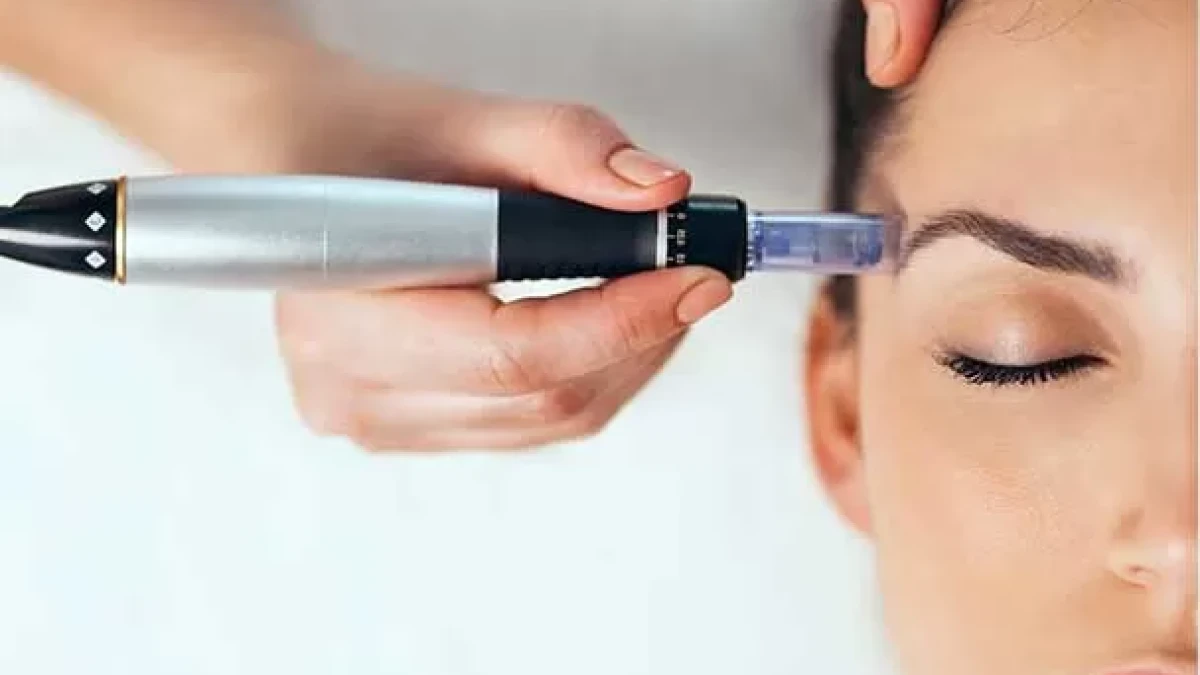 Dermapen Uygulamasının Etkileri: Gerçekten Etkili mi?