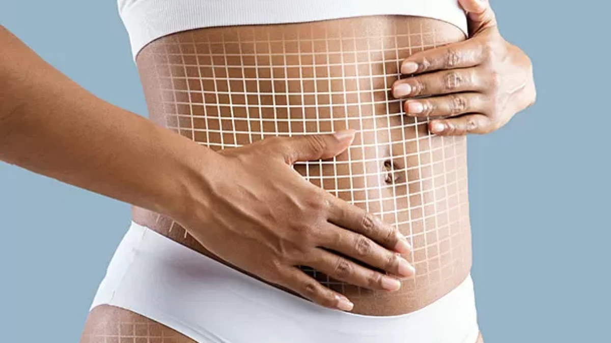 Magic Shape: The Ultimate in Body Sculpting