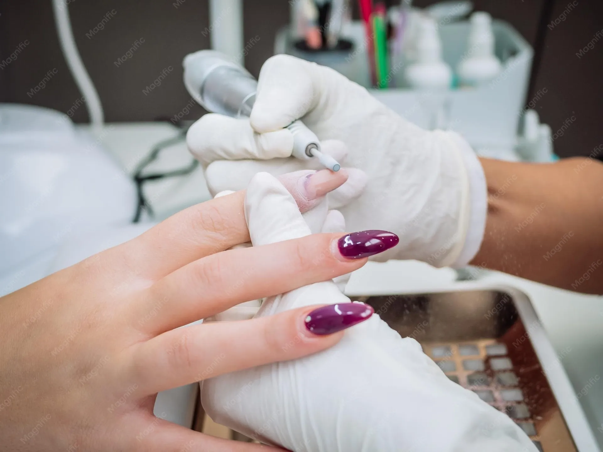 Nail Removal
