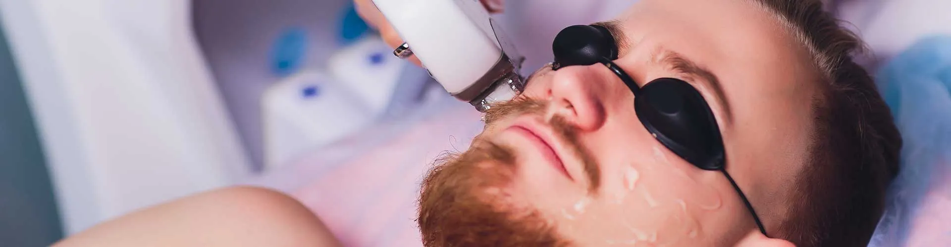 Sakal Üstü Epilasyon (Erkek)