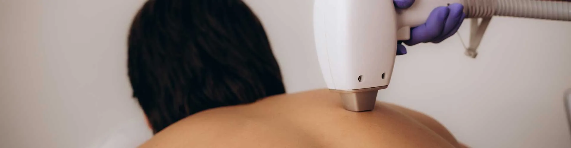 Sırt Bölgesi Epilasyon (Erkek)