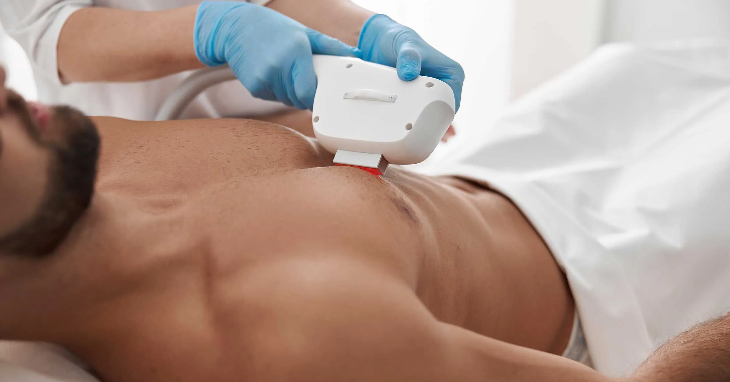 Men's Laser Hair Removal Areas Map: Sessions and Sensation by Area