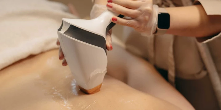 Erkek Lazer Epilasyon Bölgeleri: Kapsamlı Rehber