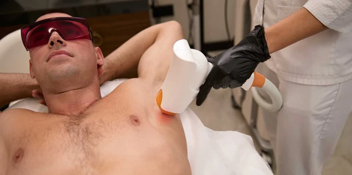 Erkeklerde Kıl Batması: Lazer Epilasyon Çözümü