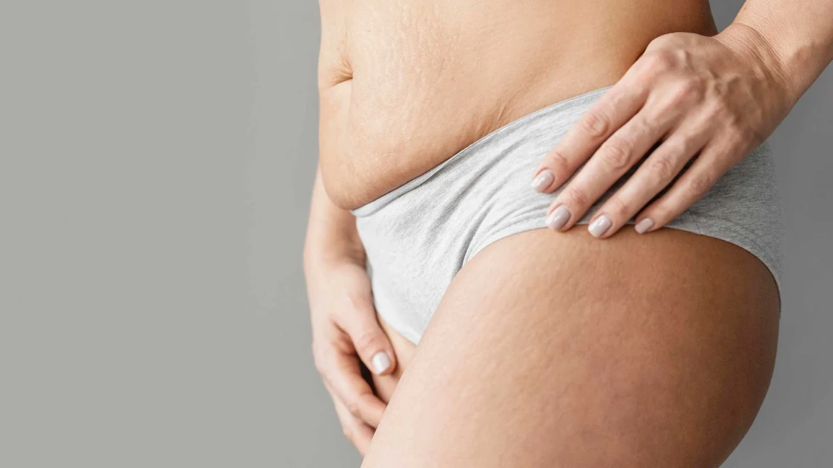 Kadınlarda Genital Epilasyon: Güvenli ve Etkili Yöntemler