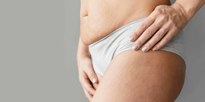 Genital Hair Removal for Women: Safe and Effective Methods