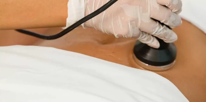 Get Rid of Fat with Cavitation