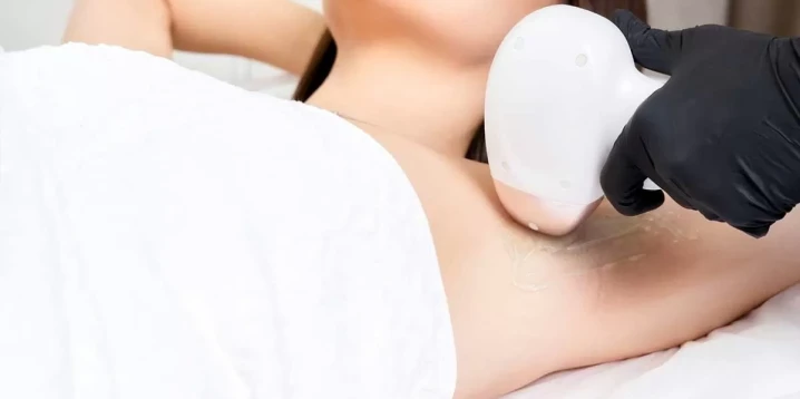 Lazer Epilasyon İçin İdeal Yaş: Doğru Zaman Ne Zaman?