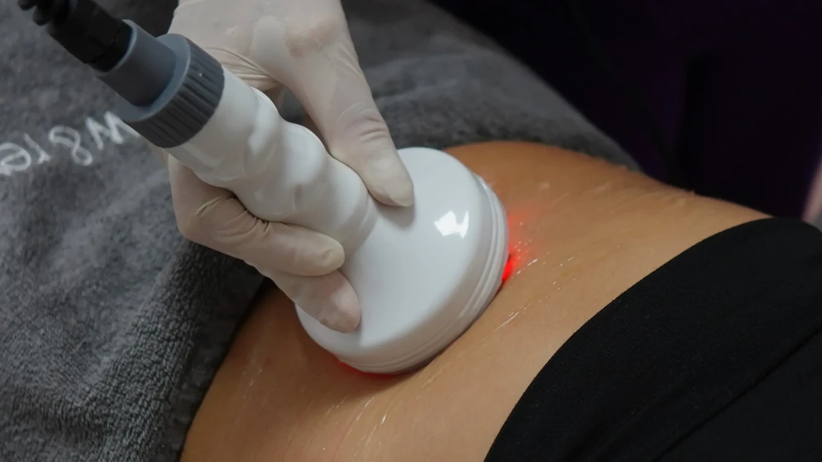 Magic Shape Body Contouring: How It Works and Results