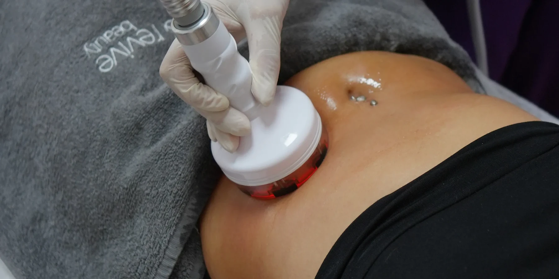 Magic Shape for Targeted Slimming: Effective on Abdomen and Legs