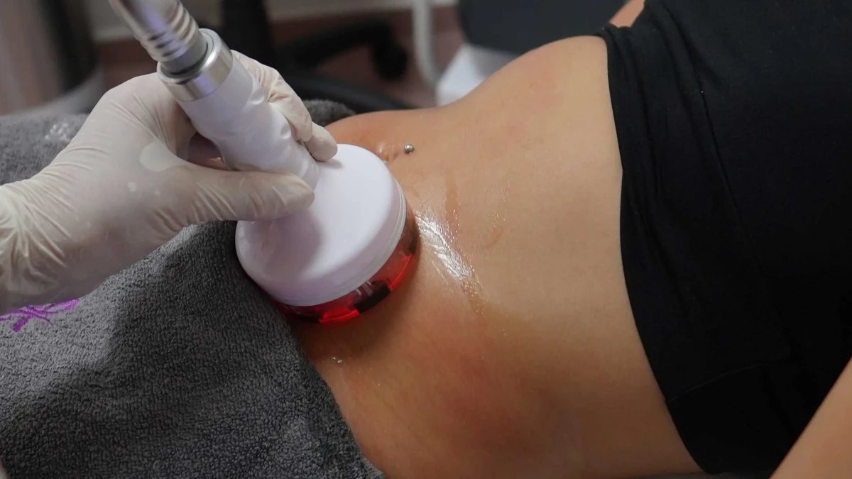 What Is Magic Shape? Benefits for Targeted Fat Reduction