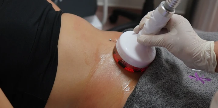 What Is Magic Shape? Effects on Belly and Leg Slimming