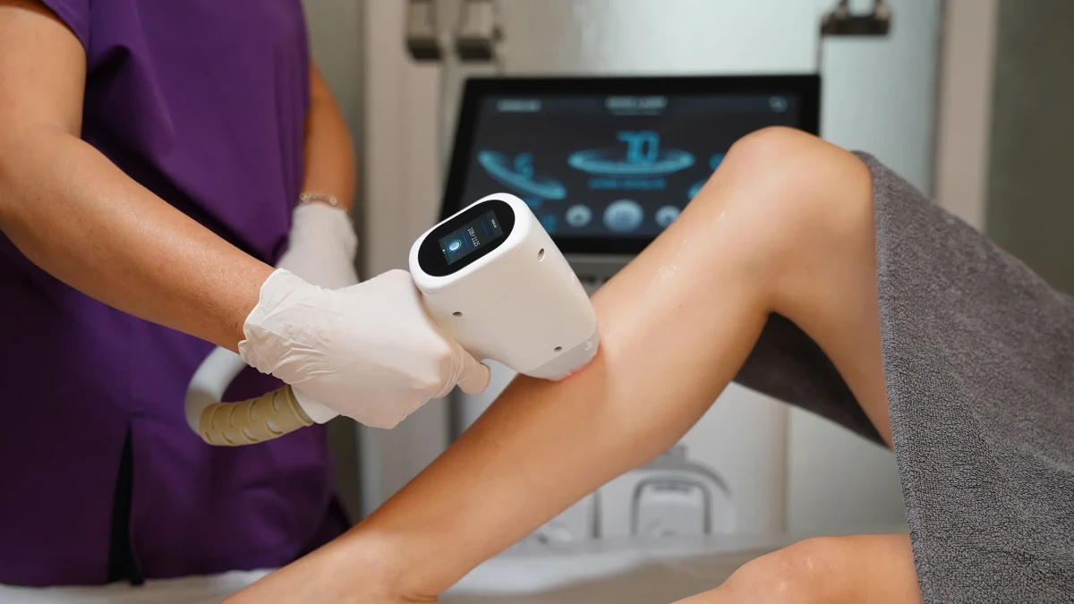 Smart Diode Ice Laser: Comfortable and Painless Hair Removal