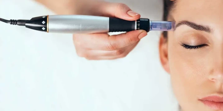 Effects of Dermapen Treatment: Is It Really Effective?