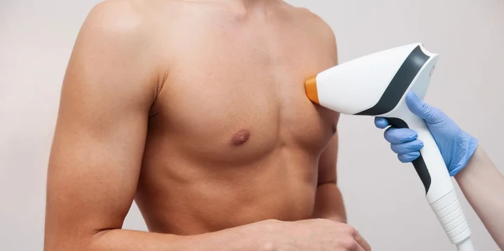 Men’s Laser Hair Removal: Effective and Safe Treatments