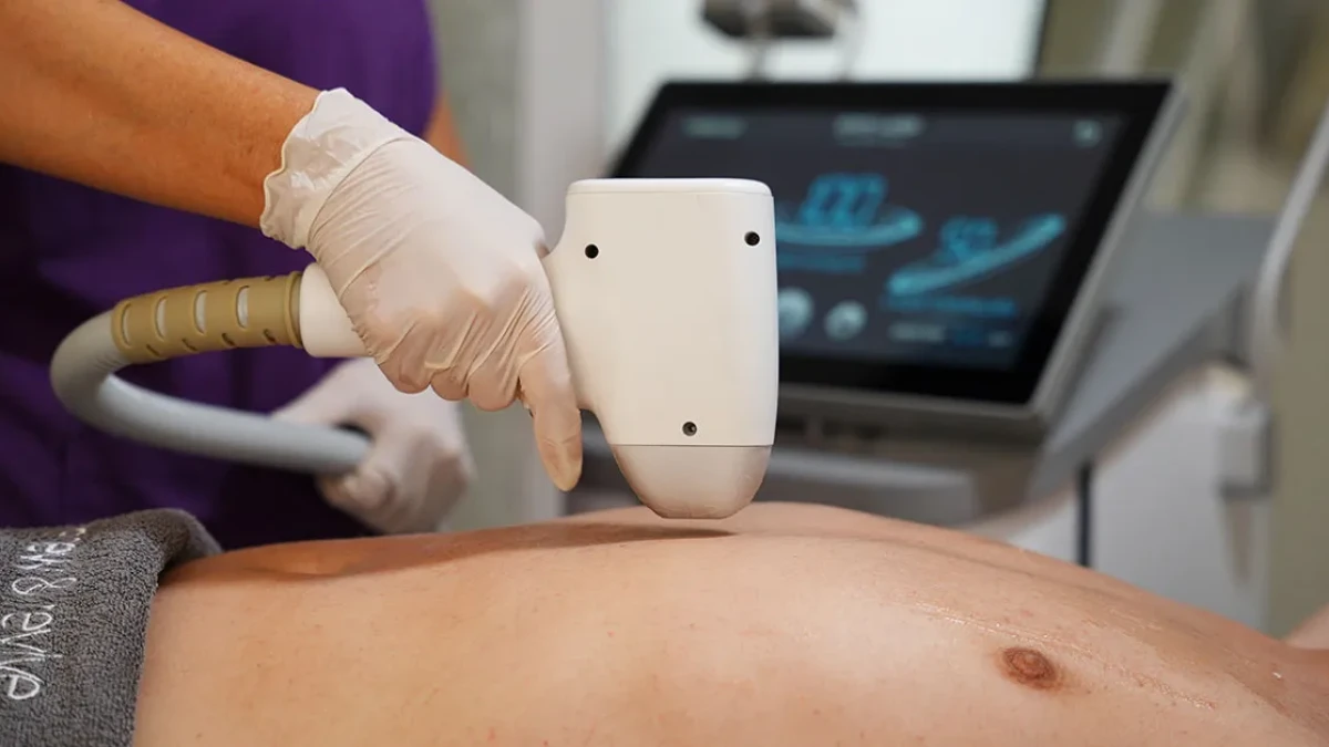 Erkek Lazer Epilasyon: Kalıcı Konfor İçin Uygulama Rehberi