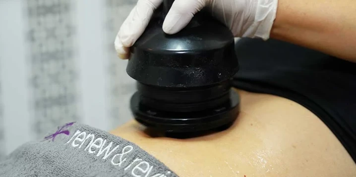 Benefits of G5 Massage: Cellulite Reduction & Body Contouring