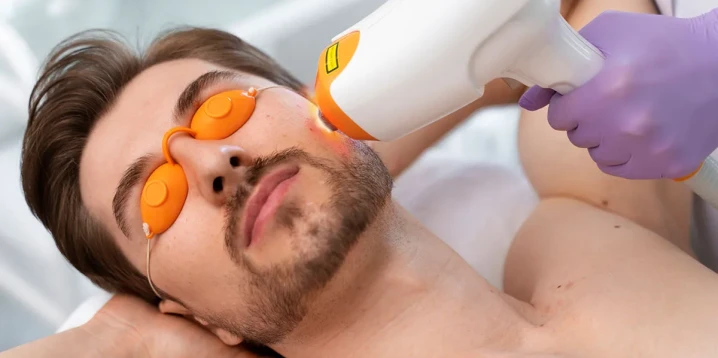 Upper Beard Hair Removal: Lasting Solutions for Men