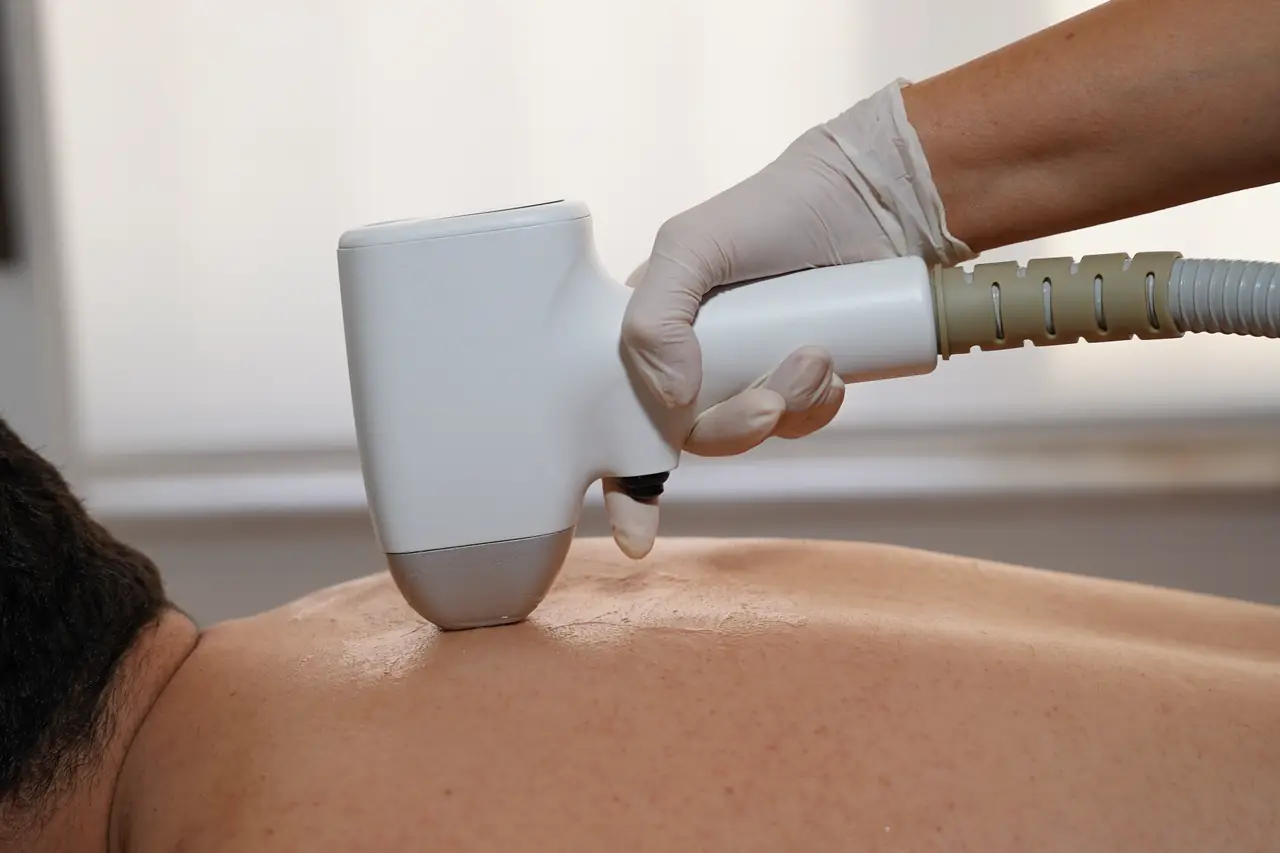 Full Body Laser Hair Removal (Male)